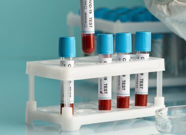 Clinical Trial Design Best Practices 33 project 14