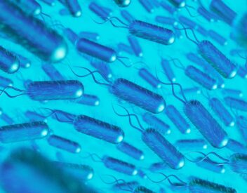 analisi legionella