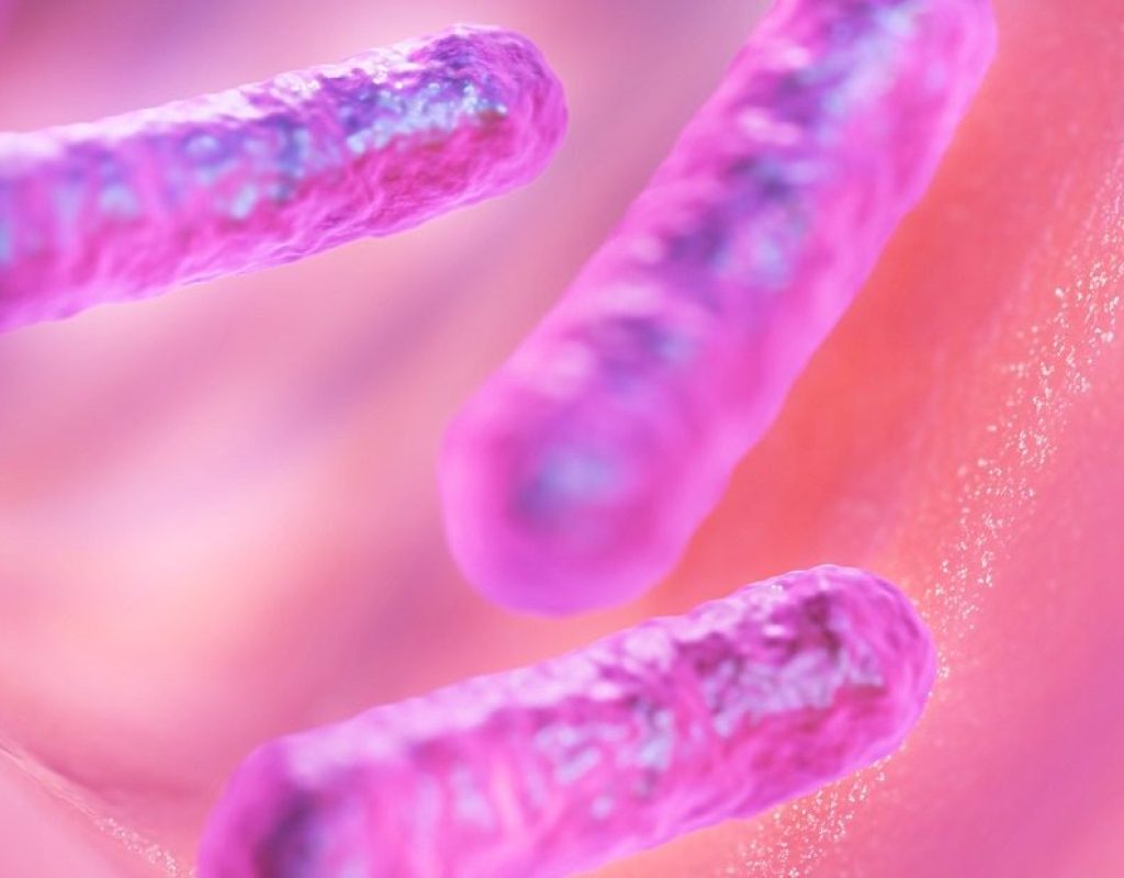 Analisi legionella