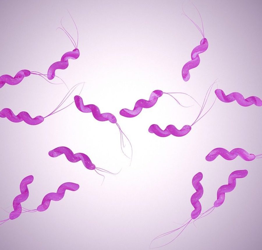 Analisi legionella
